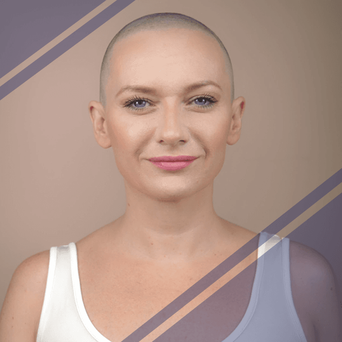 Alopecia Kerlab
